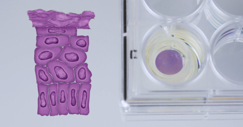 Sensinvitro Screenshot epiCS